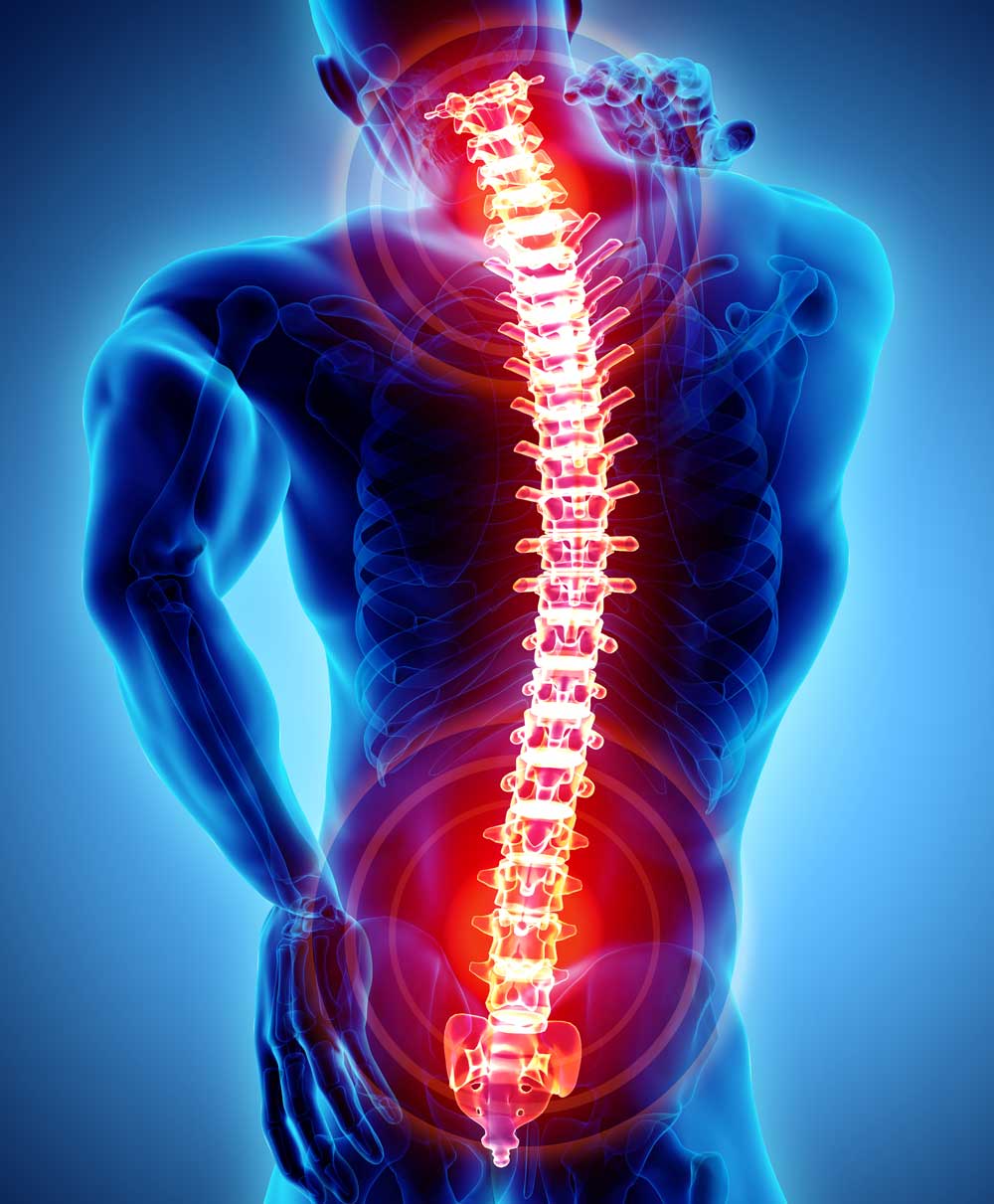 failed-back-surgery-syndrome-best-spine-surgeon-vail-aspen-denver